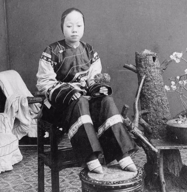 Chinese Women With Bound Feet 3