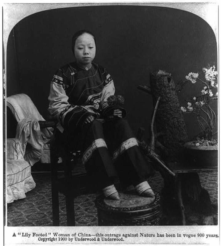 Chinese Women With Bound Feet 19