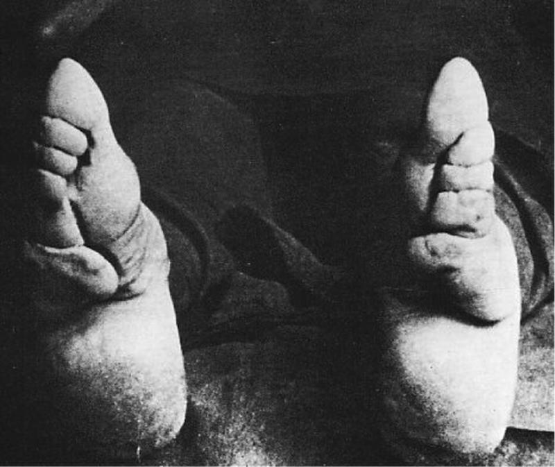 Chinese Women With Bound Feet 24